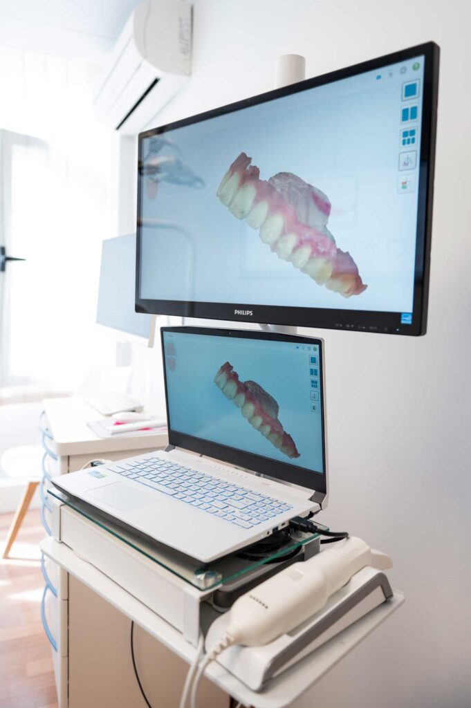 estética dental en Puertollano, carillas dentales en Puertollano, blanqueamiento en Puertollano, diseño digital de sonrisa en Puertollano, gingivectomía en Puertollano.