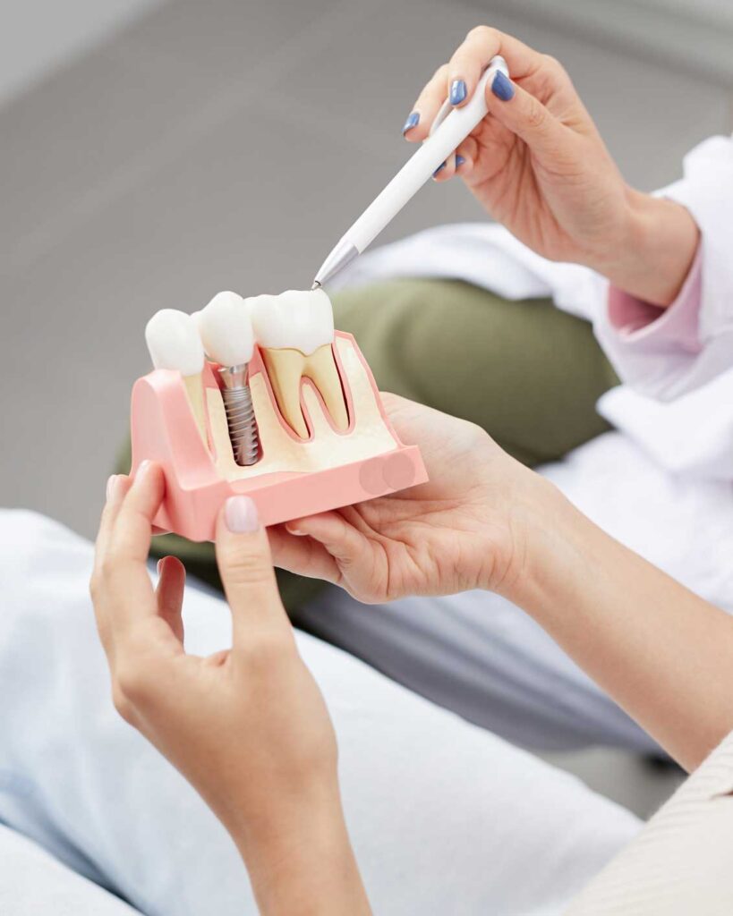 implantes dentales en Puertollano, Implantología Oral en Puertollano, implantes en Puertollano.